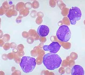 cord blood stem cells