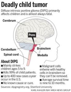32e39_20120907_052634_ssjm0909growtumor90_300